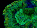 WYSIWYG - Trachyphyllia geoffroyi Ultra 9 (Skeleton 6 cm/Open 9 cm)